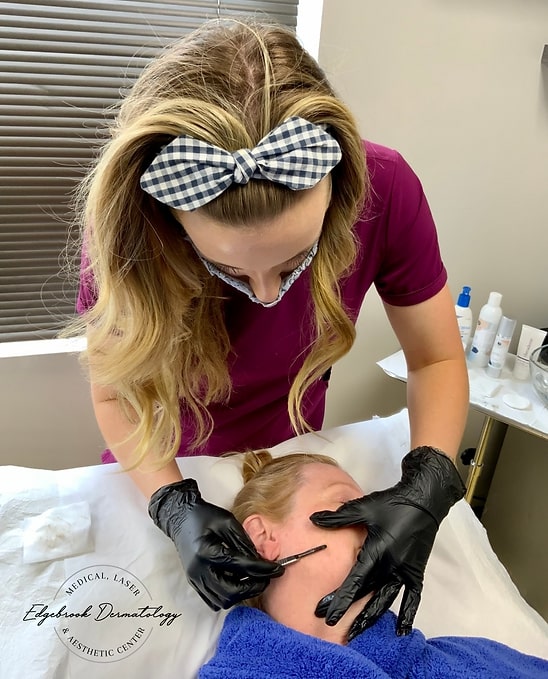 dermaplaning tx