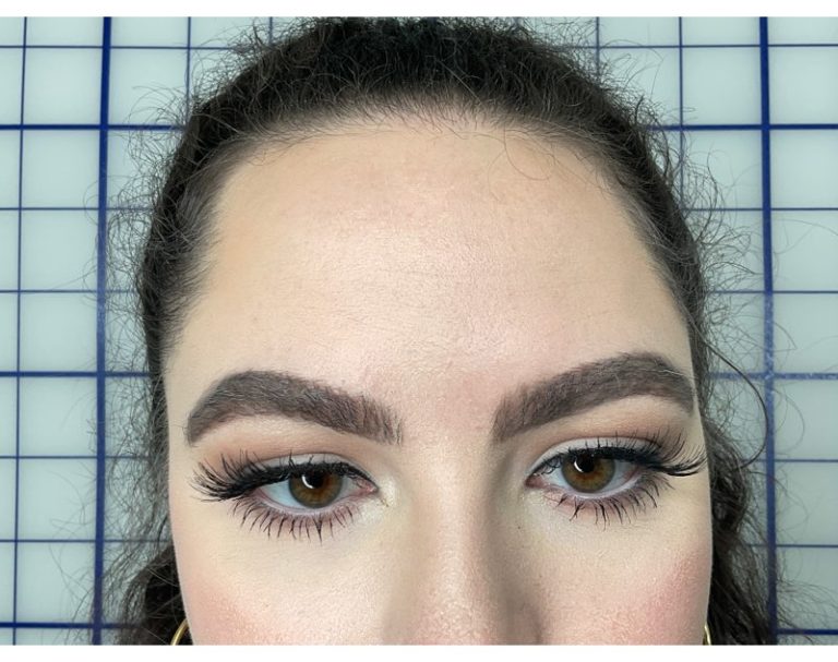 Before Image: Botox - front