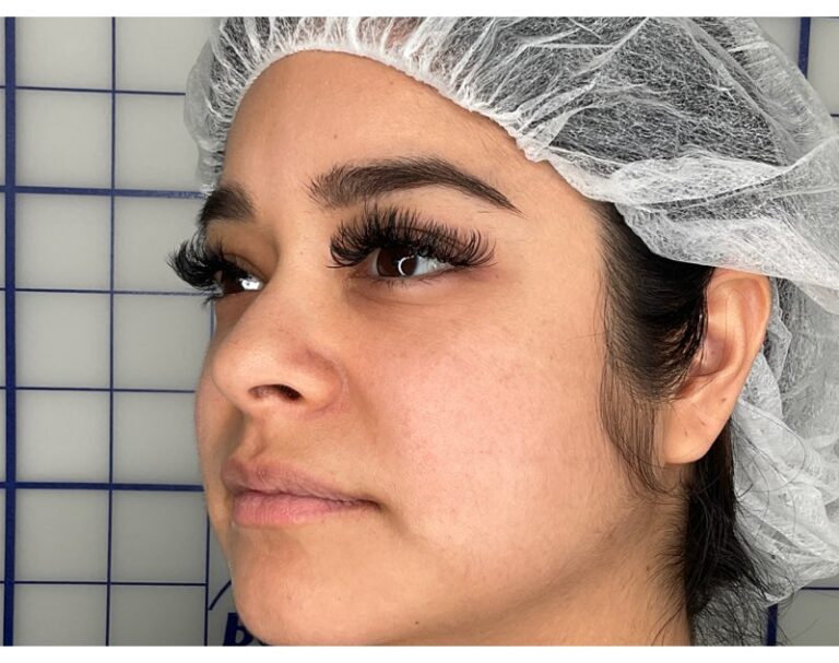 Before Image: Lip Filler - left-front-oblique