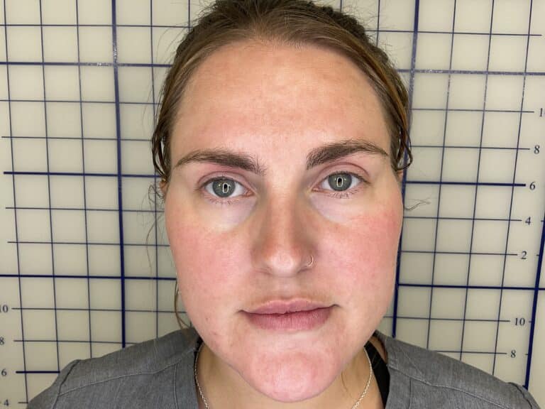After Image: Dermatology Care & Cosmetic Treatment - front