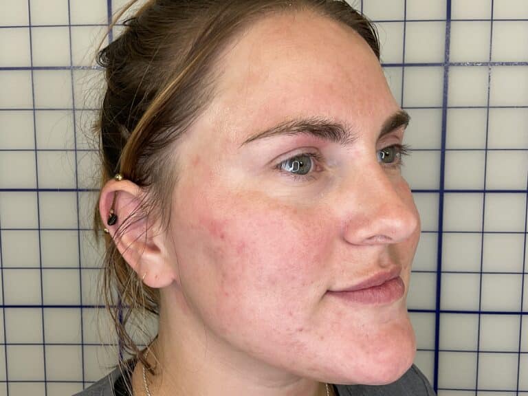 After Image: Dermatology Care & Cosmetic Treatment - right-front-oblique