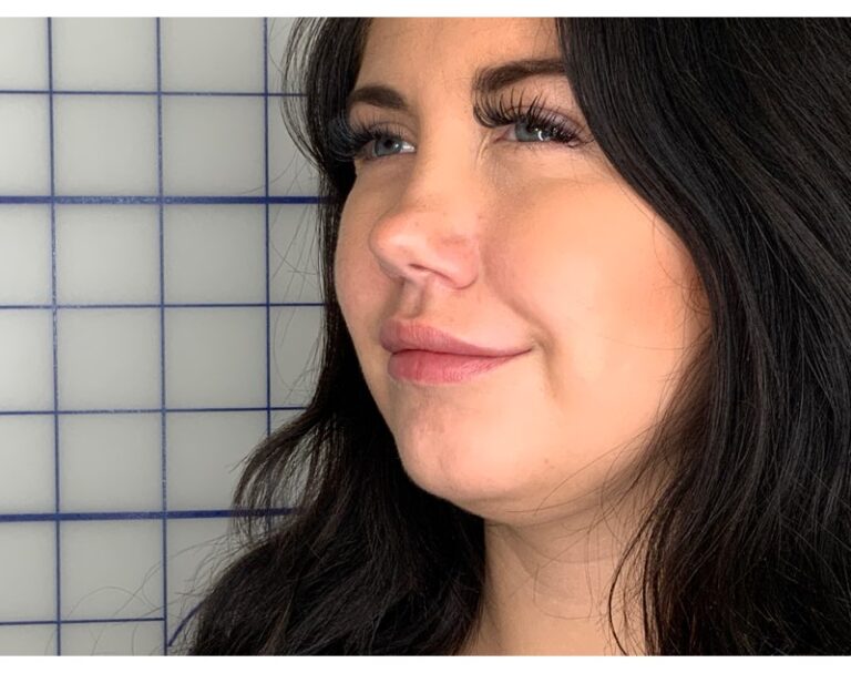 After Image: Lip Filler - left-front-oblique