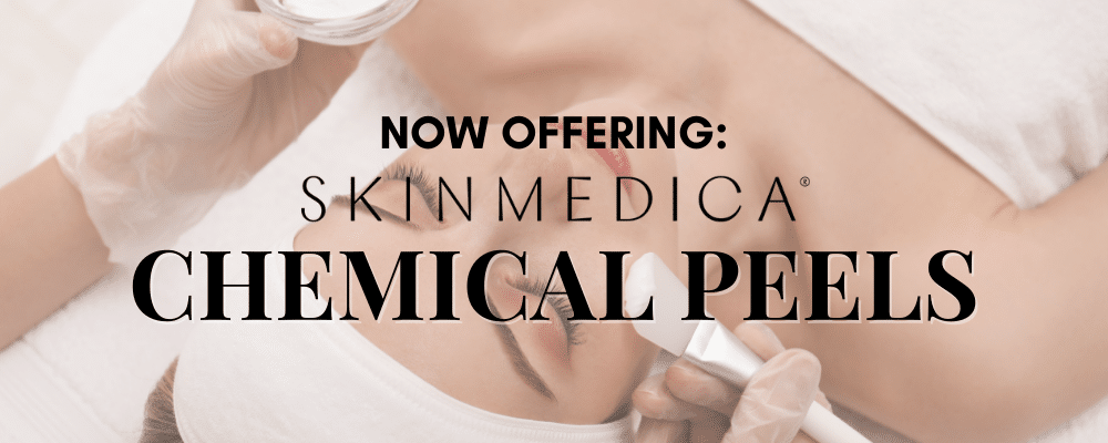 chem peel website homepage ad