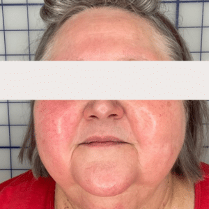 Before Image: IPL