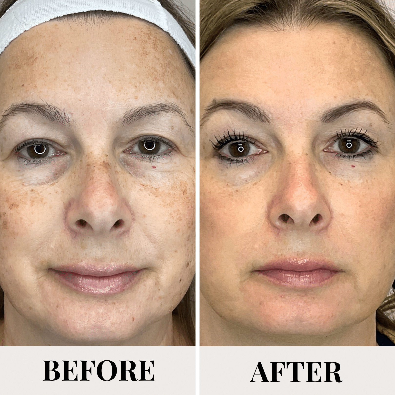 b&a collections