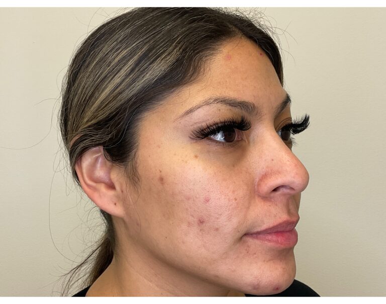 Before Image: Mayra’s Journey - front