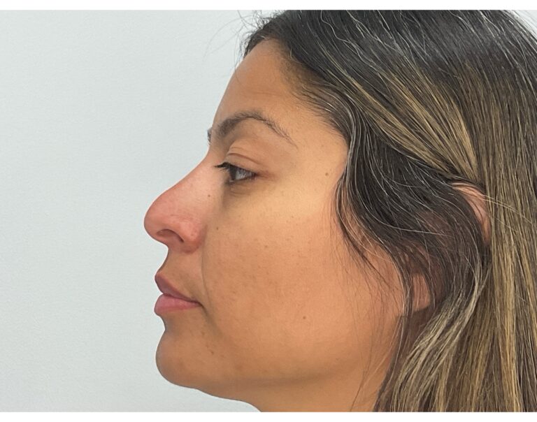After Image: Mayra’s Journey - front