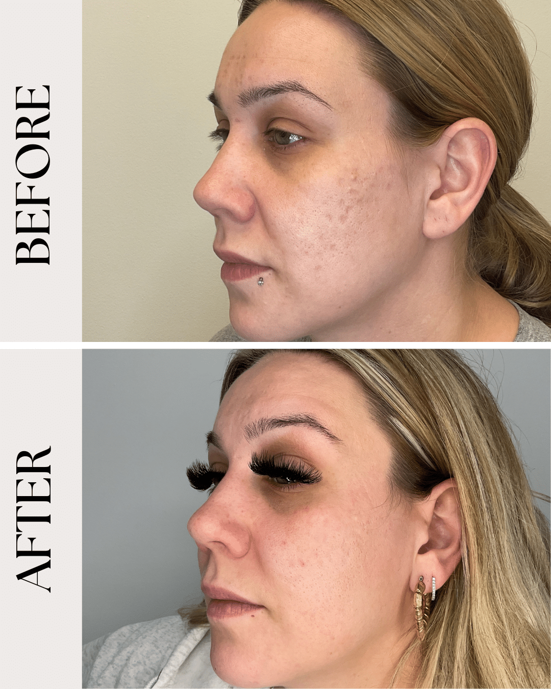before & after gallery