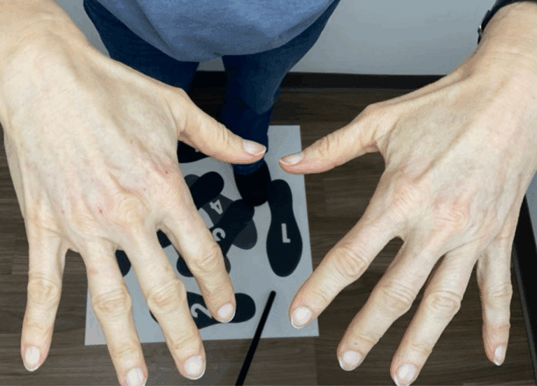 After Image: Hand Filler - front