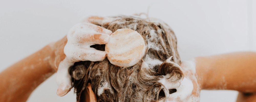 scalp